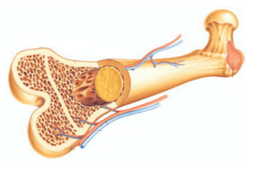 Bone Marrow Transplant