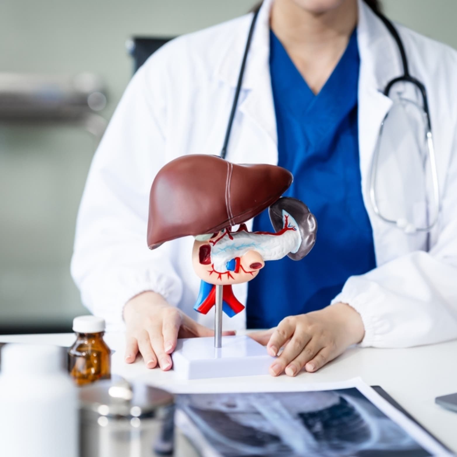 Doctor holding a liver anatomical model
