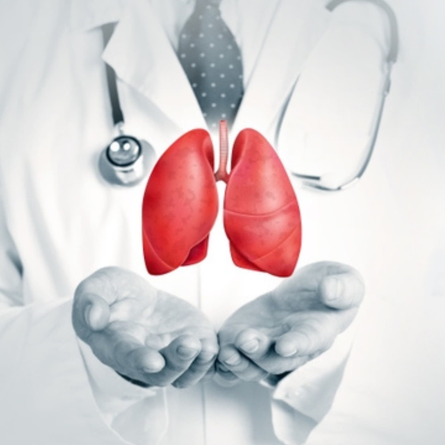 Medical illustration of lung transplant procedure